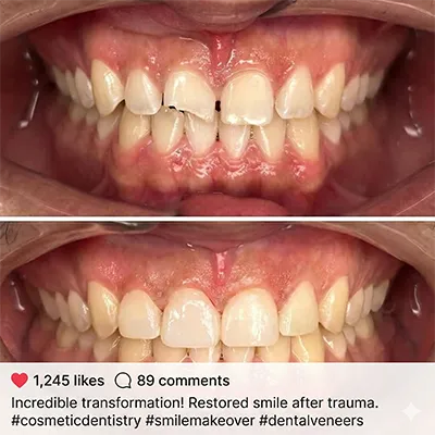 Dental procedure 